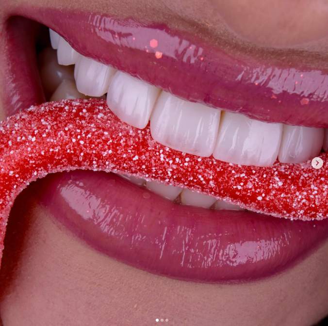 Resultado de tratamento odontológico