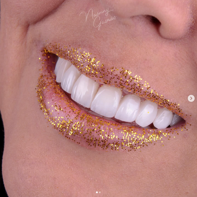 Resultado de tratamento odontológico