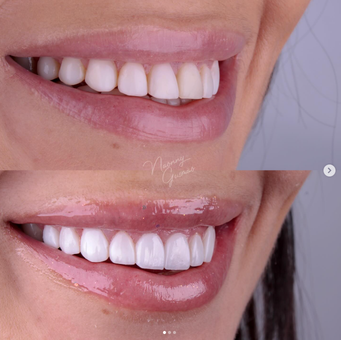 Resultado de tratamento odontológico