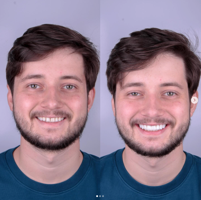 Resultado de tratamento odontológico